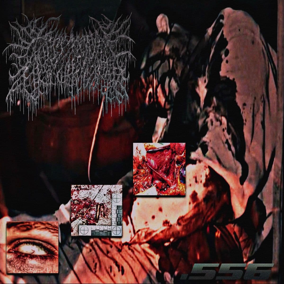 Abscesspool-.556-Single-WEB-2025-FiH